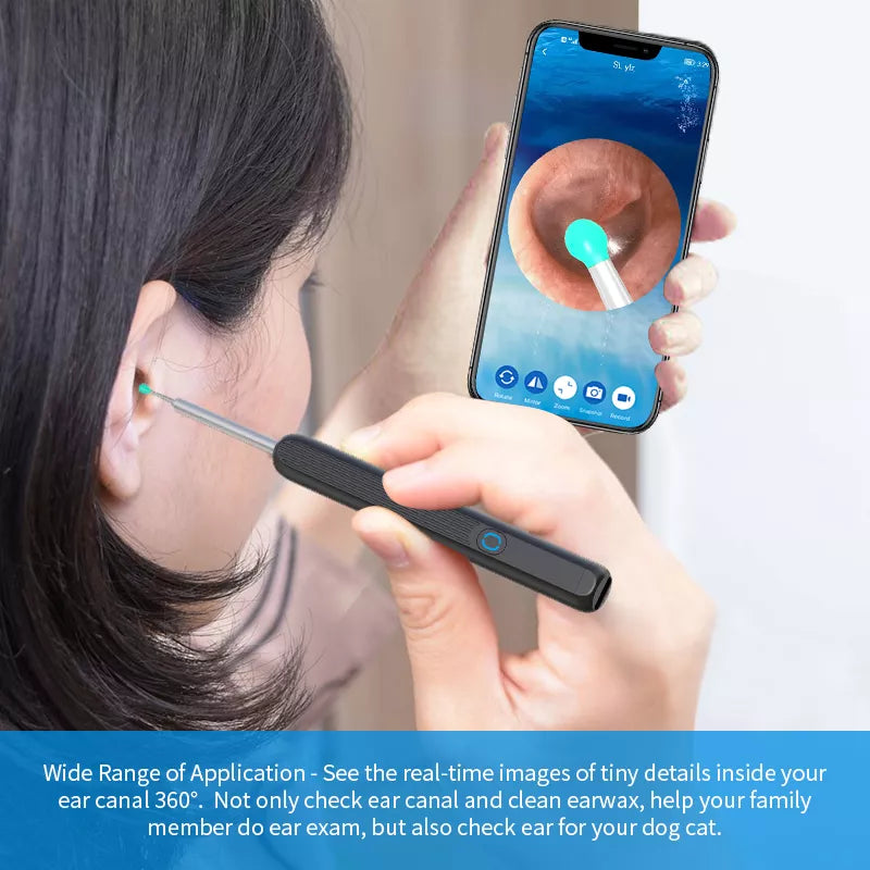 Ear Wax Removal Camera