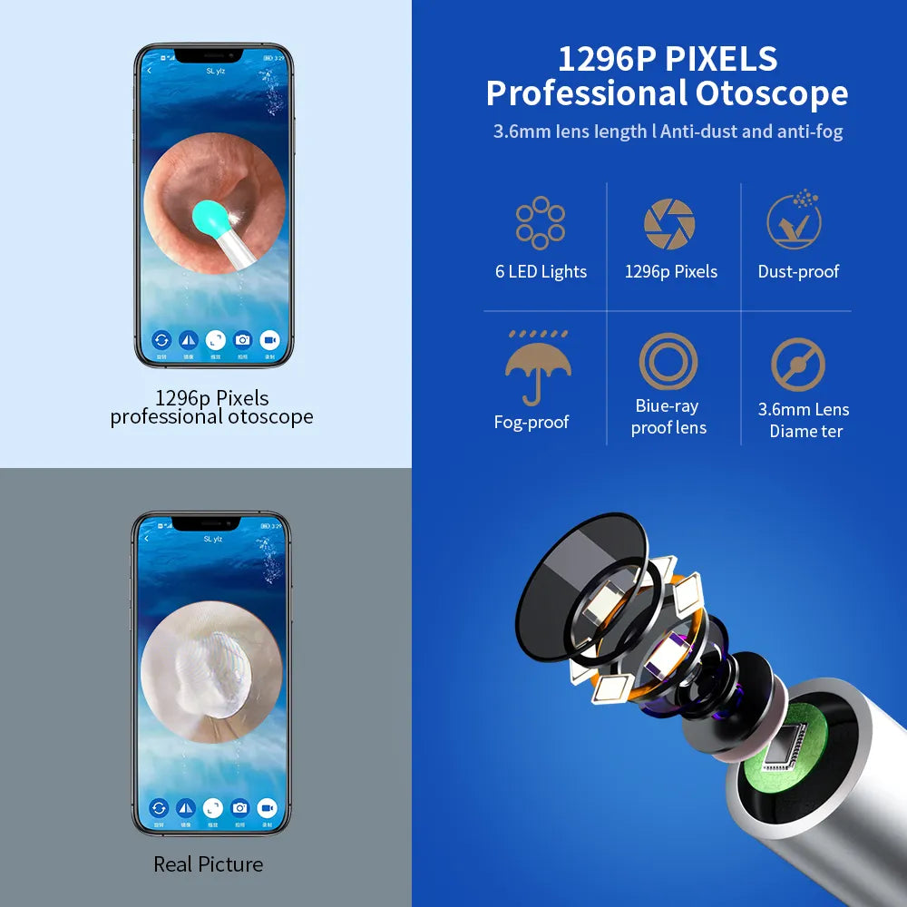 Ear Wax Removal Camera