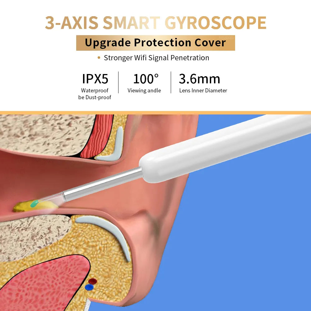Ear Wax Removal Camera