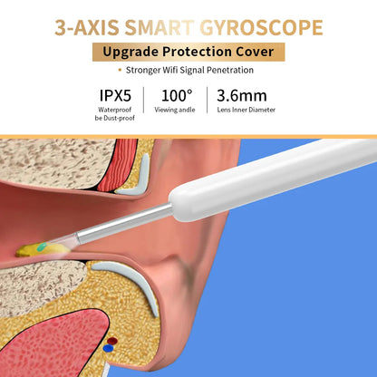 Ear Wax Removal Camera